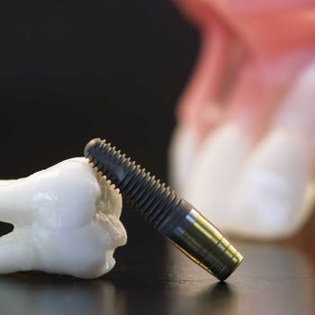 Technicien·ne en prothèse dentaire
