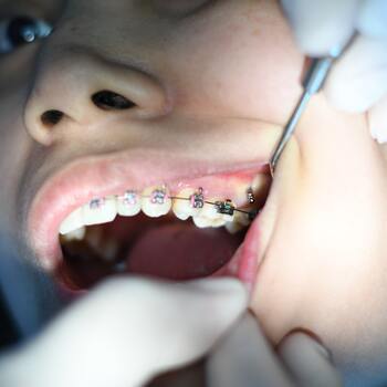 Un concours en médecine et dentisterie en août 2023 : quels changements par rapport à l’examen d’entrée ?